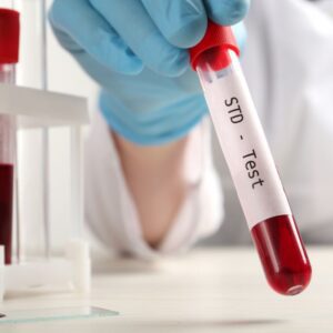 Comprehensive STD Testing
